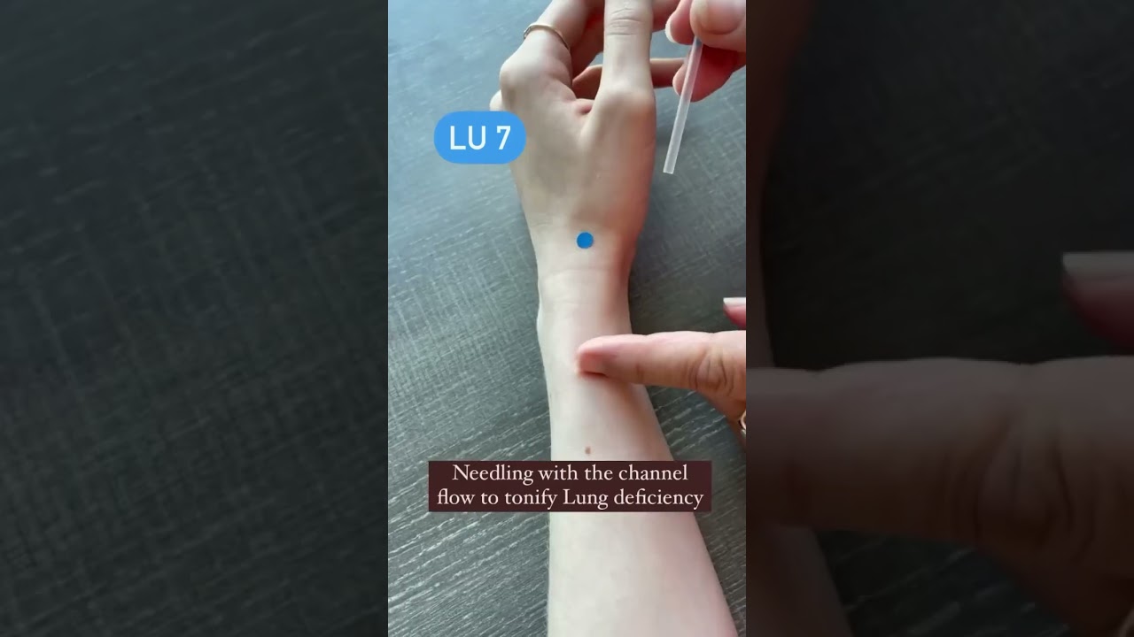 📍Needling LU 7 Acupuncture Point #acupuncturepoints