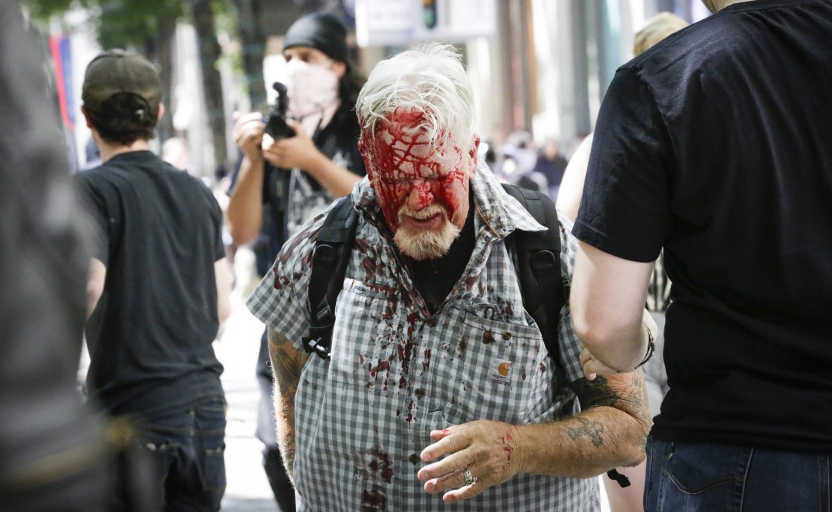 Běžnou taktikou, kterou Antifa používá ve Spojených státech i v Evropě, je vyvolávání extrémních násilností a ničení veřejného a soukromého majetku s cílem vyprovokovat tvrdý zásah policie, který "potvrdí", že vláda je "fašistická". Na snímku: Starší muž odchází poté, co byl brutálně zbit členy skupiny Rose City Antifa 29. června 2019 v Portlandu ve státě Oregon. (Moriah Ratner / Getty Images)