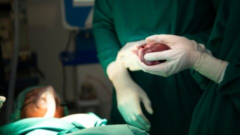 Nizozemec žije 40 let s darovaným srdcem, byl zapsán do knihy rekordů
