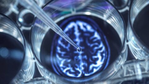 „Archiv mozků“ podruhé v ČR. Napomůže zkoumání Parkinsonovy nebo Alzheimerovy nemoci