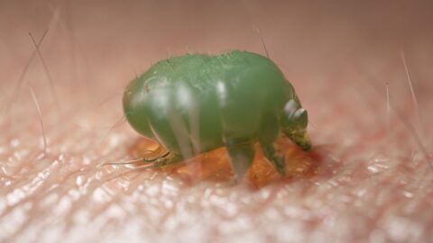 Svrab se v Praze šíří rychleji než v předchozích letech, informují hygienici