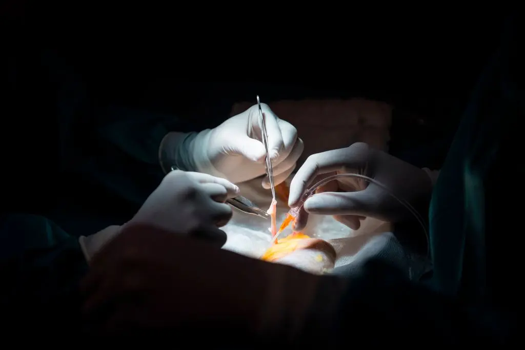 Lékaři se připravují na transplantaci ledviny, archivní snímek. (Pierre-Philippe Marcou / AFP / Getty Images)