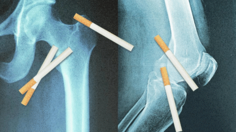 Vaše kosti si „pamatují“ cigarety, které jste vykouřili