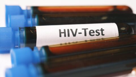 Nových případů HIV v Česku bylo loni 293, nejvíce v historii sledování