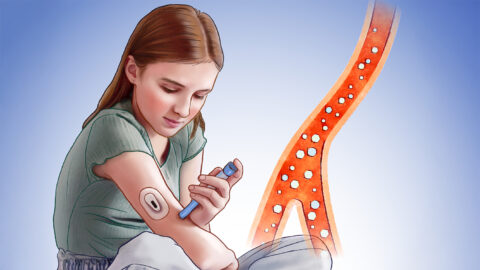 Diabetes 1. typu je časté autoimunitní onemocnění. Jaké jsou jeho příčiny?