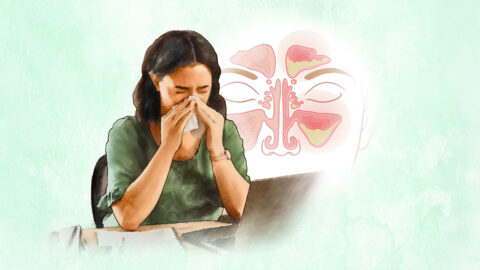 Zánět vedlejších nosních dutin: Příznaky, příčiny, léčba a přírodní přístupy