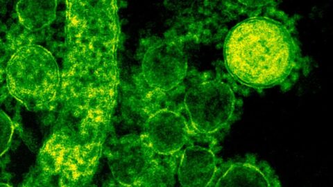 WHO: Epidemie eboly v Kongu a Ugandě je ohrožení zdraví mezinárodního významu
