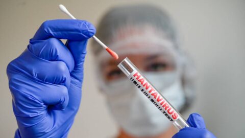 Francie hlásí první potvrzený případ hantaviru u pasažérky z výletní lodi