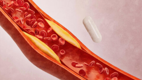 Vitamin K2 může pomáhat zpomalovat kornatění tepen, naznačuje studie